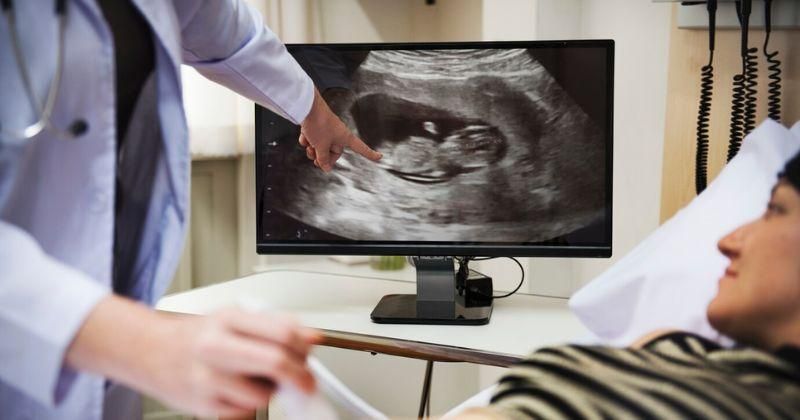 Bentuk Kantung Janin yang Keluar saat Keguguran Sesuai Usia Kehamilan